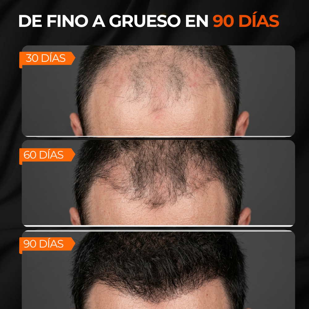 Shampoo para bloquear el DHT y activar el crecimiento capilar