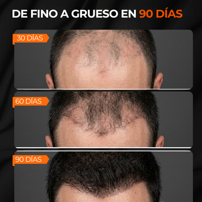 Shampoo para bloquear el DHT y activar el crecimiento capilar